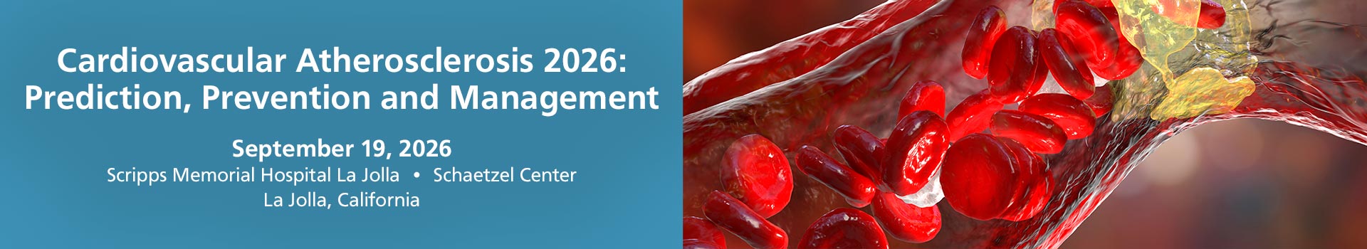 Cardiovascular Atherosclerosis 2026